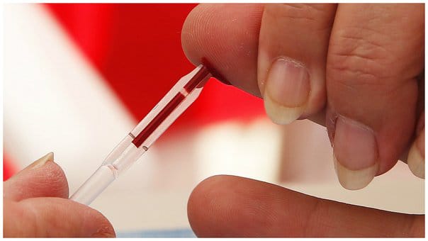 Reciben antirretrovirales afiliados al Seguro Popular con diagnóstico de VIH