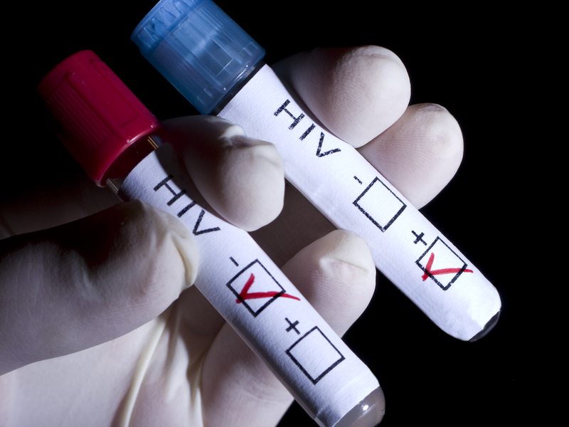 Al año se detectan 32 casos de VIH en pruebas rápidas, en Hidalgo