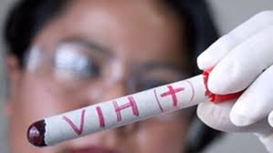 Van 364 nuevos casos de VIH detectados este año en Hidalgo