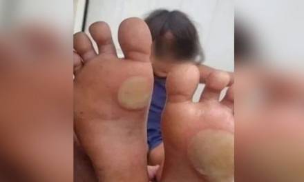 Mujer le quema los pies a su hija con una plancha