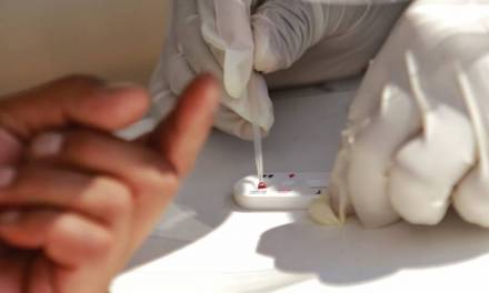 Registra Hidalgo más de 2 mil pacientes que padecen VIH