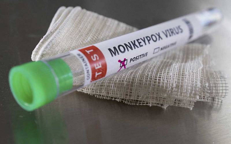 Detectan 2 nuevos casos de viruela del mono en México