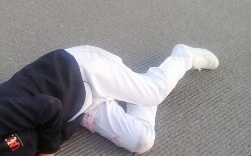 Estudiante de la UAEH es atropellada sobre bulevar Colosio