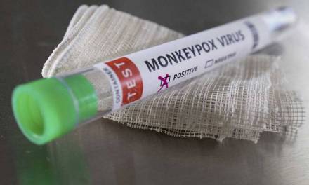 Se han estudiado 20 casos de viruela del mono en Hidalgo