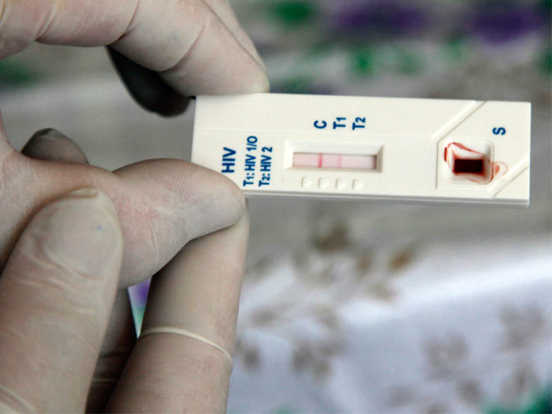 Detectan 10 casos de VIH en mujeres embarazadas