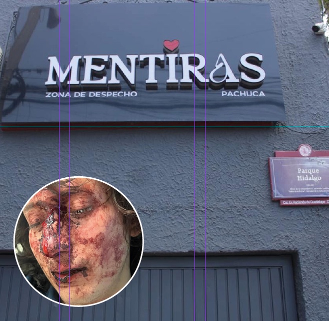 Denuncian agresiones en bar de Pachuca