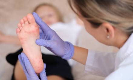 Detectan 32 brotes y 144 contagios de virus Coxsackie en Hidalgo