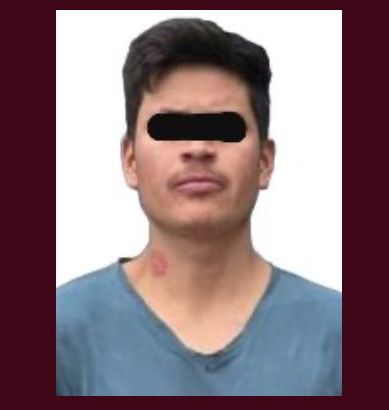 Aseguran en El Arenal a presunto implicado en robo de patrulla