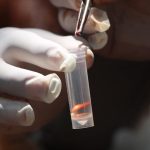 Caso de gusano barrenador en humano pone en alerta al Sector Salud 