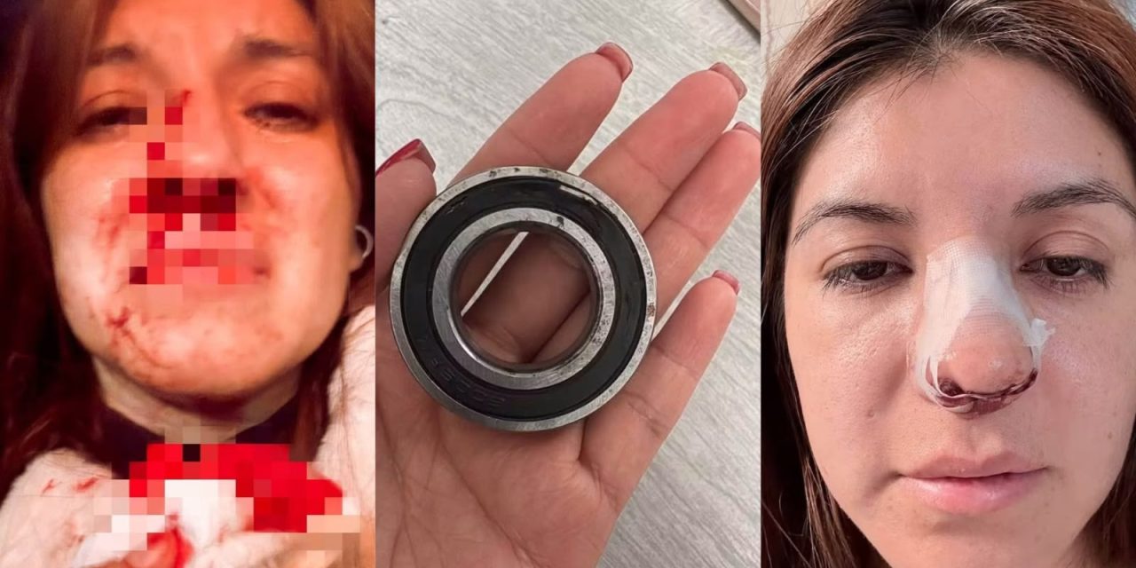 Pelea de choferes de combi termina con pasajera herida en Pachuca