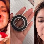 Pelea de choferes de combi termina con pasajera herida en Pachuca