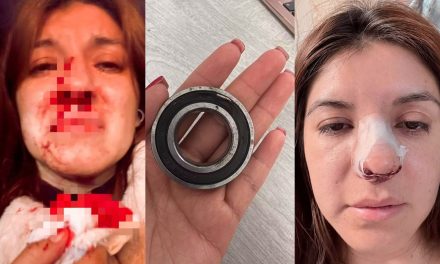 Pelea de choferes de combi termina con pasajera herida en Pachuca