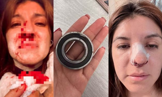 Pelea de choferes de combi termina con pasajera herida en Pachuca